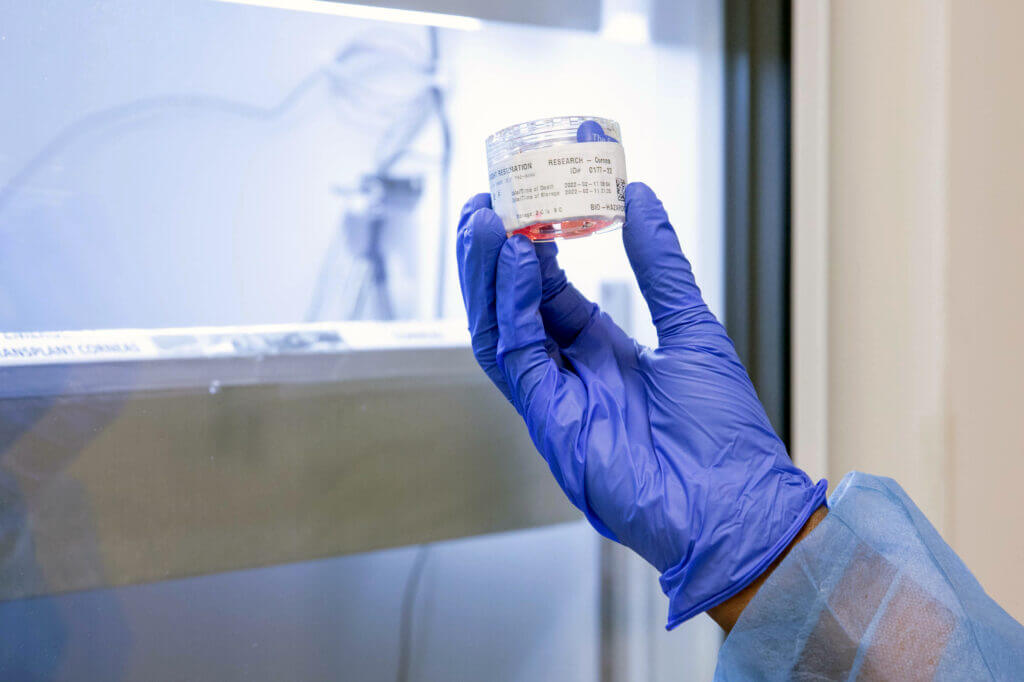 An eye bank technician holds up a jar labeled "Cornea-Research"